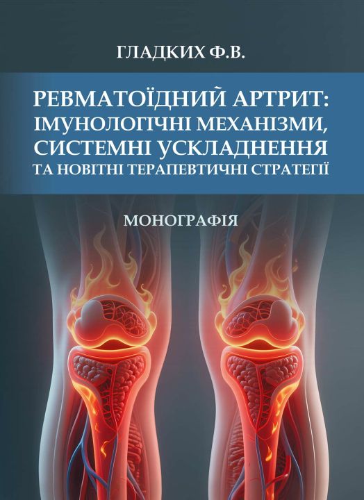 Ревматоїдний артрит: імунологічні механізми, системні ускладнення та новітні терапевтичні стратегії Ревматоїдний артрит: імунологічні механізми, системні ускладнення та новітні терапевтичні стратегії
